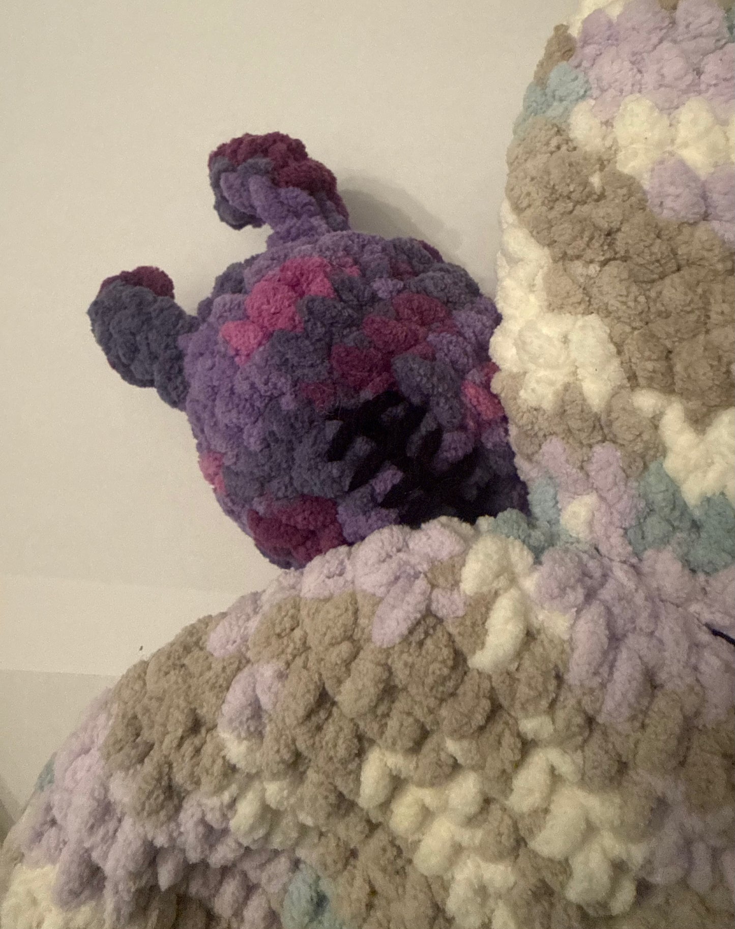 Chiari Decompression Butterfly