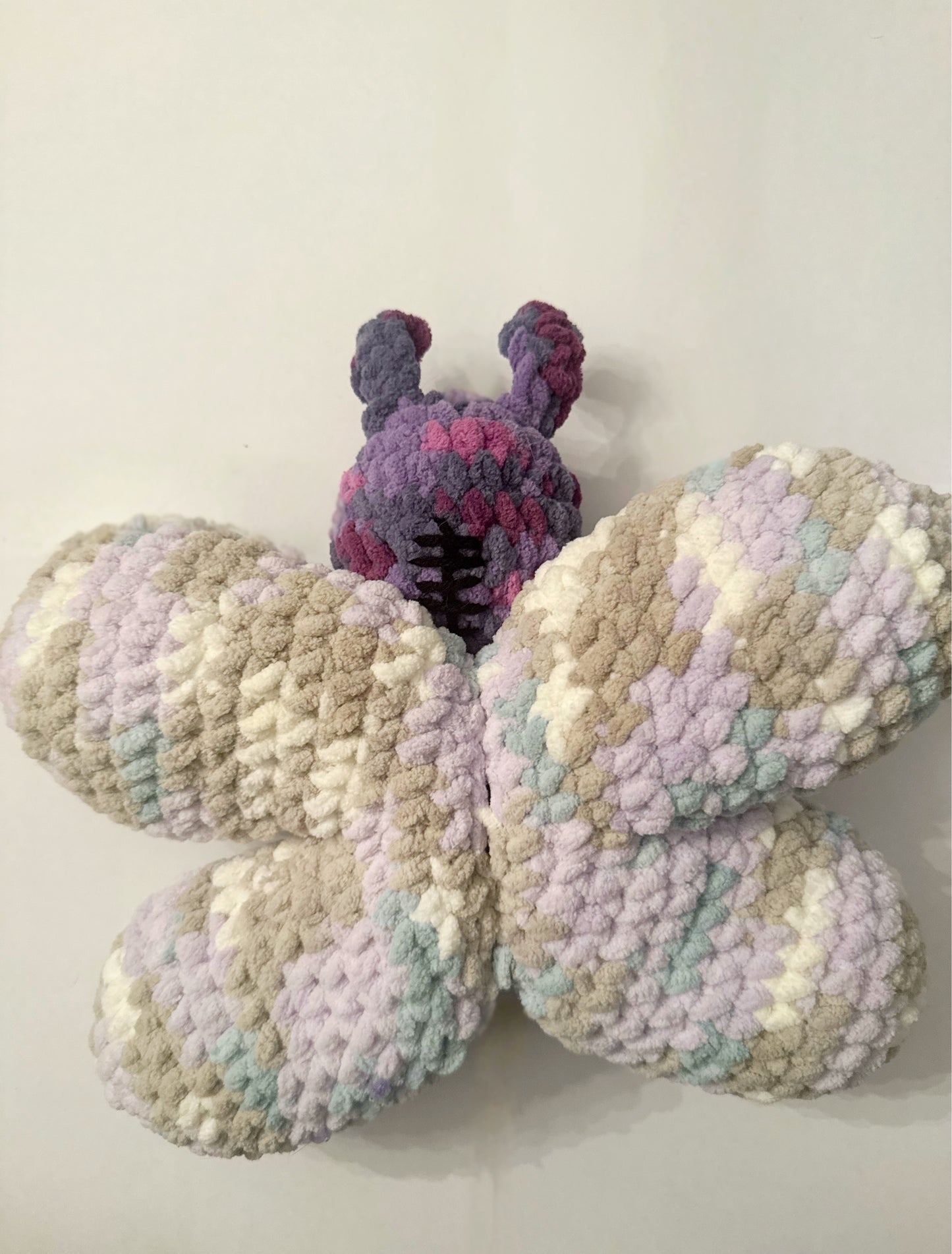 Chiari Decompression Butterfly